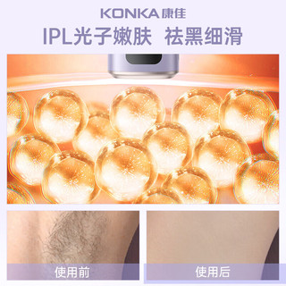 KONKA 康佳 冰点家用脱毛仪