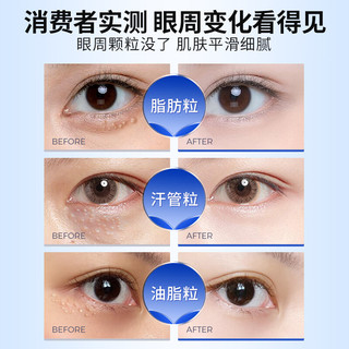 EXPRESSIONS进口眼霜汗管粒眼部淡化细纹黑眼圈改善脂肪粒男女眼周专用 眼霜60ml（两支装）