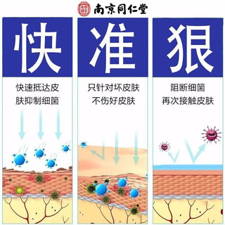 南京同仁堂狼毒去喷剂止痒脚气克星脱皮脚丫烂水泡型去脚痒脚臭喷雾抑菌脚汗 一盒体验装60ml+20g