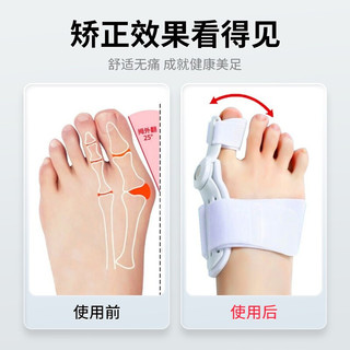 脚趾矫正器分趾器大母脚趾头足纠正可以穿鞋男女士通用款拇指外翻