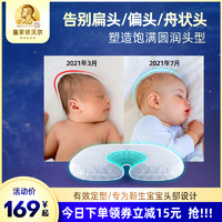 诺贝尔贝比 软管定型枕防偏头透气纠正矫正头型0-1岁新生儿宝宝夏季婴儿枕头