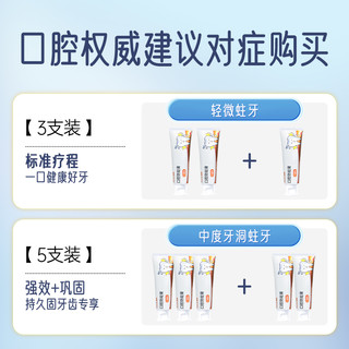 普迈迪口腔防蛀膏宝宝防蛀牙防龋齿固齿封闭牙窝沟点隙儿童型lt