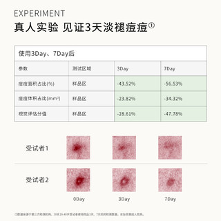 艾酸氏20%壬二酸祛痘凝胶任露杜鹃花酸 含2%水杨酸果酸