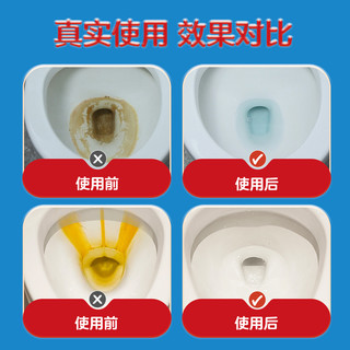 尿碱溶解剂马桶清洁剂强力除尿垢洁厕卫生间除垢去黄尿渍清洗家用