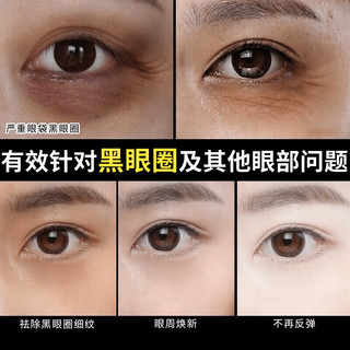 BAINHR 黄金眼膜贴黑眼圈眼袋细纹法令纹皱纹提亮眼周补水紧致眼部护理