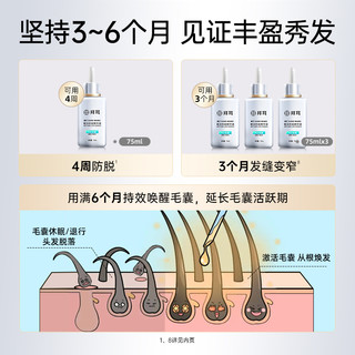 KANGWANG 康王 拜耳康王腺苷防脱发小银瓶防脱固发赋活头皮精华液150ml