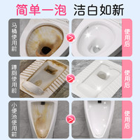 老管家尿碱溶解剂马桶清洁强力去除污垢黄渍清洗厕尿检渍洁厕清香