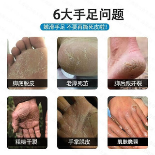 隆力奇蛇油护手霜双效防护蛇油膏裂可宁霜男女秋冬锁水保湿防干 蛇油护手霜70g*5支