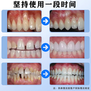YIHOU 医后 氨基酸牙膏牙龈护理温和护龈修护牙膏固齿亮白清新口气110g