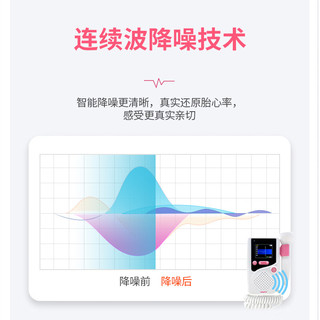 贝缤纷胎心仪多普勒听胎心家用胎心监测仪胎音仪听诊器 家用医用听胎心音H7-D充电