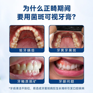 牙高医生菌斑可视牙膏高氟防蛀牙防龋齿正畸显色牙菌斑成人及正畸薄荷牙膏 1盒