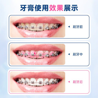 牙高医生菌斑可视牙膏高氟防蛀牙防龋齿正畸显色牙菌斑成人及正畸薄荷牙膏 1盒