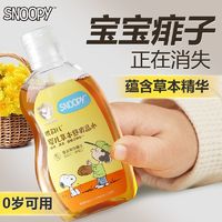 SNOOPY 史努比 宝宝舒痱止痒金水花露水婴儿家用金银花夏季儿童防痱