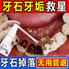 可福佳牙结石型口腔冲洗器喷雾牙齿膏去味口臭去牙齿黄溶解去渍牙石30ml