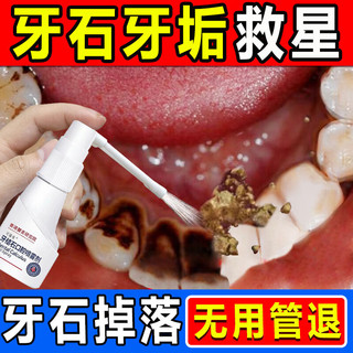 可福佳牙结石型口腔冲洗器喷雾牙齿膏去味口臭去牙齿黄溶解去渍牙石30ml