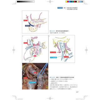 腹腔镜外科局部解剖图谱:解剖路径与手术操作 图书