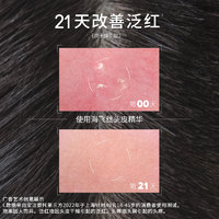 海飞丝 专研头皮精华去屑止痒改善干燥泛红100mlx2