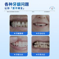 88VIP：葵花 医用脱敏牙膏牙周炎专用牙龈萎缩修复再生护理出血肿痛抗敏感