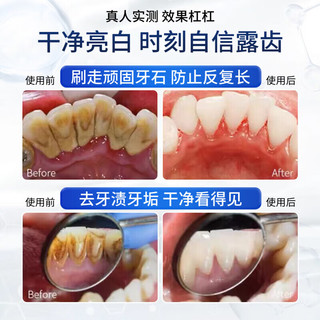 FUNCGGI377亮白益生菌牙膏口臭去黄去牙渍去烟渍牙膏牙结石清新口气护龈 美白去渍益生菌牙膏 120ml 1盒