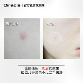 稀拉克儿（Ciracle） 升级粉色祛痘修护液2ml迷你版随身小魔瓶夜间点涂祛痘摇摇乐 5只装，双头棉棒