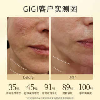 GIGI New Age G4美颈霜淡化颈纹提拉紧致抗皱纹初老颈霜蓝铜胜肽