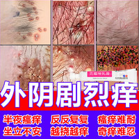 恒久远 克霉唑软膏 外阴瘙痒妇科专用药妇科消炎药 用于治多种妇科炎症外阴瘙痒妇科用药专用私处