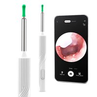 NATFIRE 智能可视挖耳勺NE18掏耳朵神器内窥镜耳镜成人宝宝采耳棒白色款