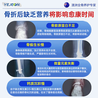 Yejeon骨折骨裂恢复的药骨折营养品促进骨头愈合骨伤骨折钙片增加骨密度