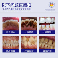 沃朗森医用非牙膏去牙结石溶解牙石速效去口臭除异味口气清新