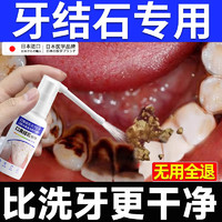 倾姿堂 牙结石口腔喷雾冲洗剂牙齿膏去味口臭去黄溶解去渍牙石速效30ml