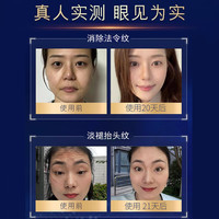 溪下晨光法国面霜抗皱紧致抗衰老淡化细纹川字纹法令川字纹去除男女士 【全脸0皱】抗老护肤品晚霜